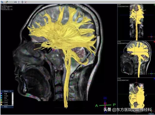 精神疾病不治疗的后果,精神疾病患者久治不愈的根本原因