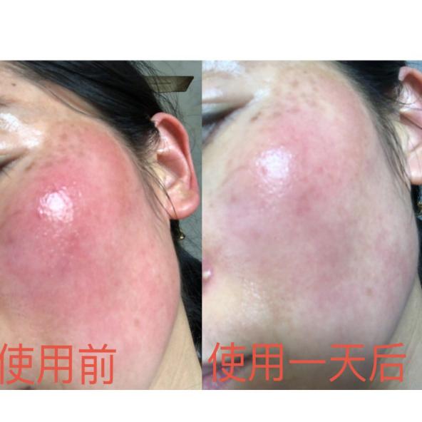 快问快答面膜篇,快问快答护肤问题