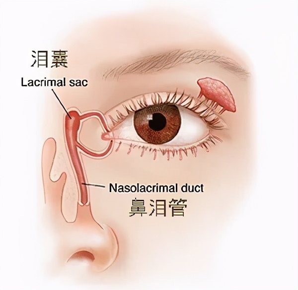 6岁小孩眼睛突然大量出眼屎,2岁孩子突然眼睛有眼屎是黄脓状