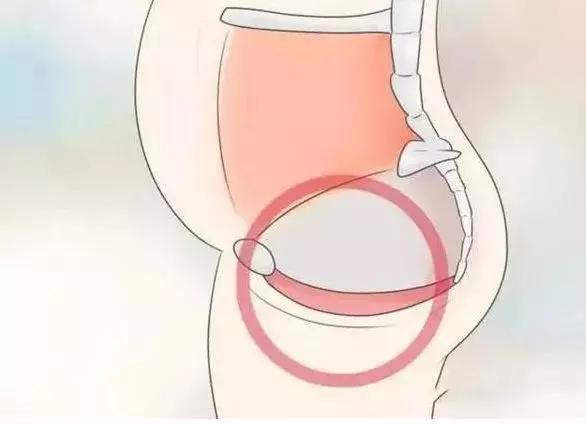 ella谈产后漏尿,ella产后漏尿