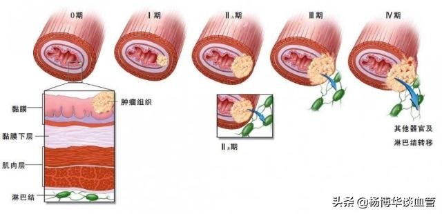 每次口腔溃疡淋巴结肿大怎么回事,口腔溃疡引起淋巴结肿大怎么消除
