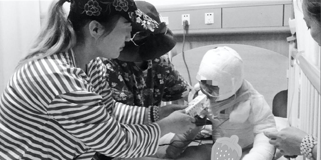 18楼起火一家三口被严重烧伤大面积烧伤要如何救治？