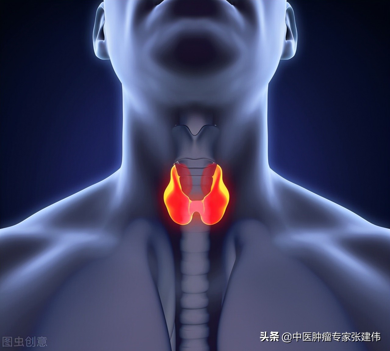 甲状腺低回声结节是恶性结节吗,甲状腺结节4a恶性结节是癌吗