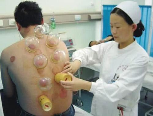 拔罐黑是有瘀血吗,拔罐要怎么才能更好拔出黑印