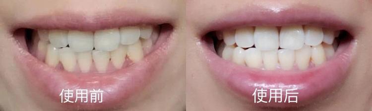 明星都在用的白牙齿牙膏,明星同款美白牙齿的牙膏