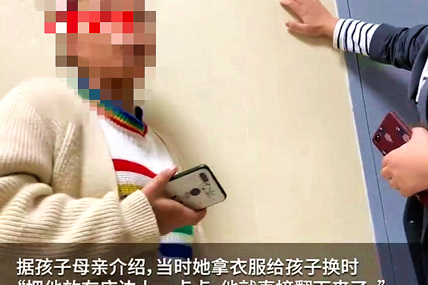 江西2男童体内插绣花针险些丧命,男童体内被插绣花针险些丧命