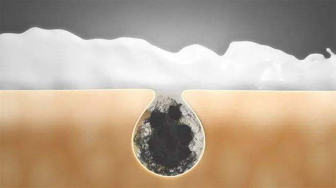 收缩毛孔粗大的方法测评,拯救粗大毛孔的救星来啦