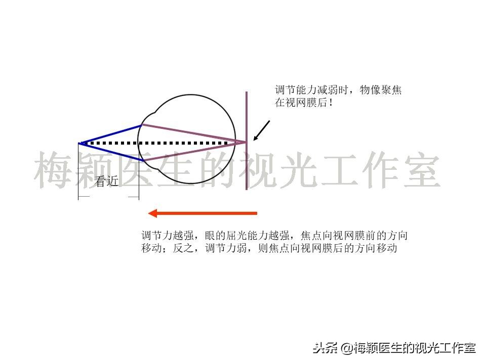 低浓度阿托品的临床应用经验