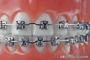 诺尔漫齿科淄博张店,淄博诺尔漫口腔科