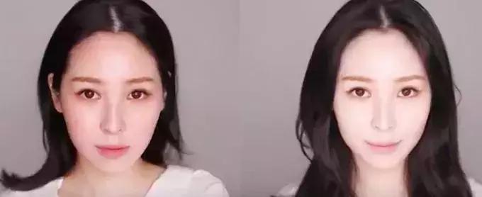 欧阳娜娜擦的药膏,欧阳娜娜擦什么药膏