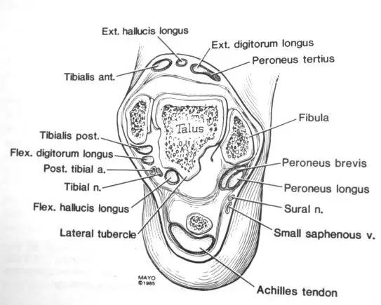 踝关节撞击症问诊,踝关节内侧撞击综合症位置图
