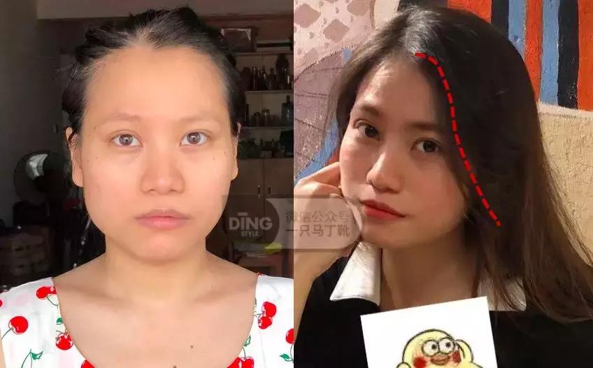 脸大小不对称怎么矫正,如何改善大小脸不对称