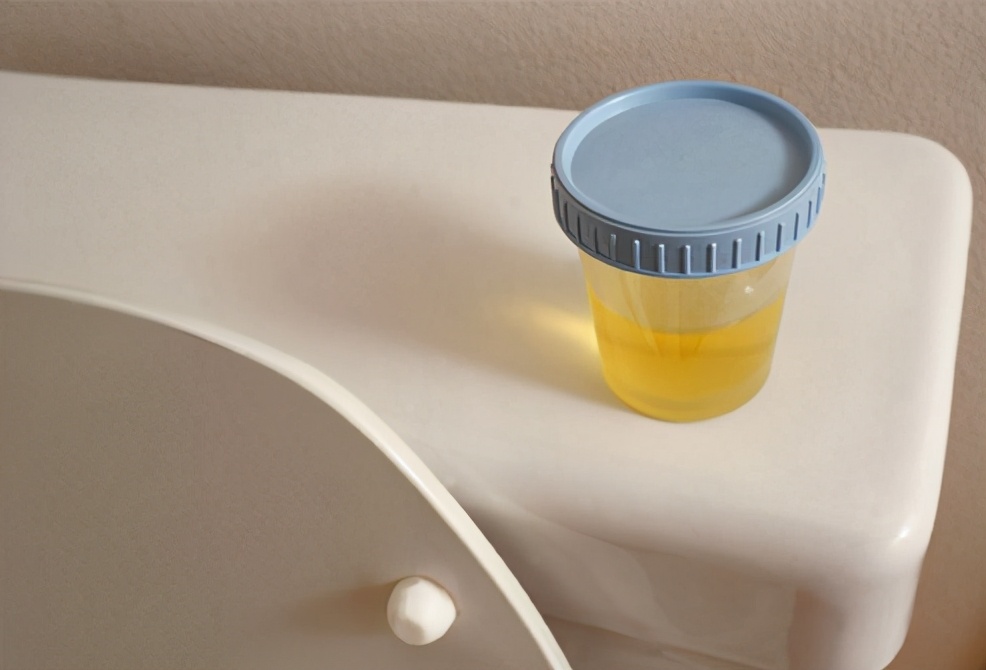 一打喷嚏就漏尿，怎么才能治好？泌尿医生详解尿*禁失**该如何拯救