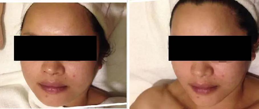 雅特雪小魔瓶原理,西班牙雅特雪护肤品效果怎么样