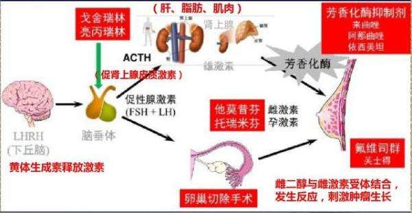 哪种类型乳腺癌适合做免疫治疗,哪种性质的乳腺癌用内分泌治疗