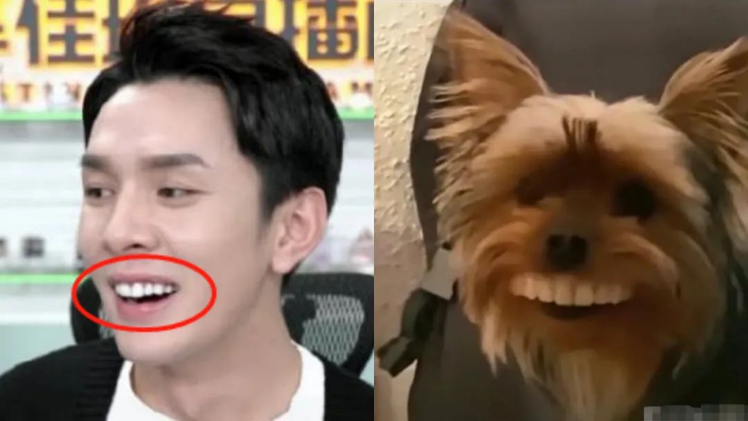 明星做了烤瓷牙翻车,烤瓷牙李佳琦