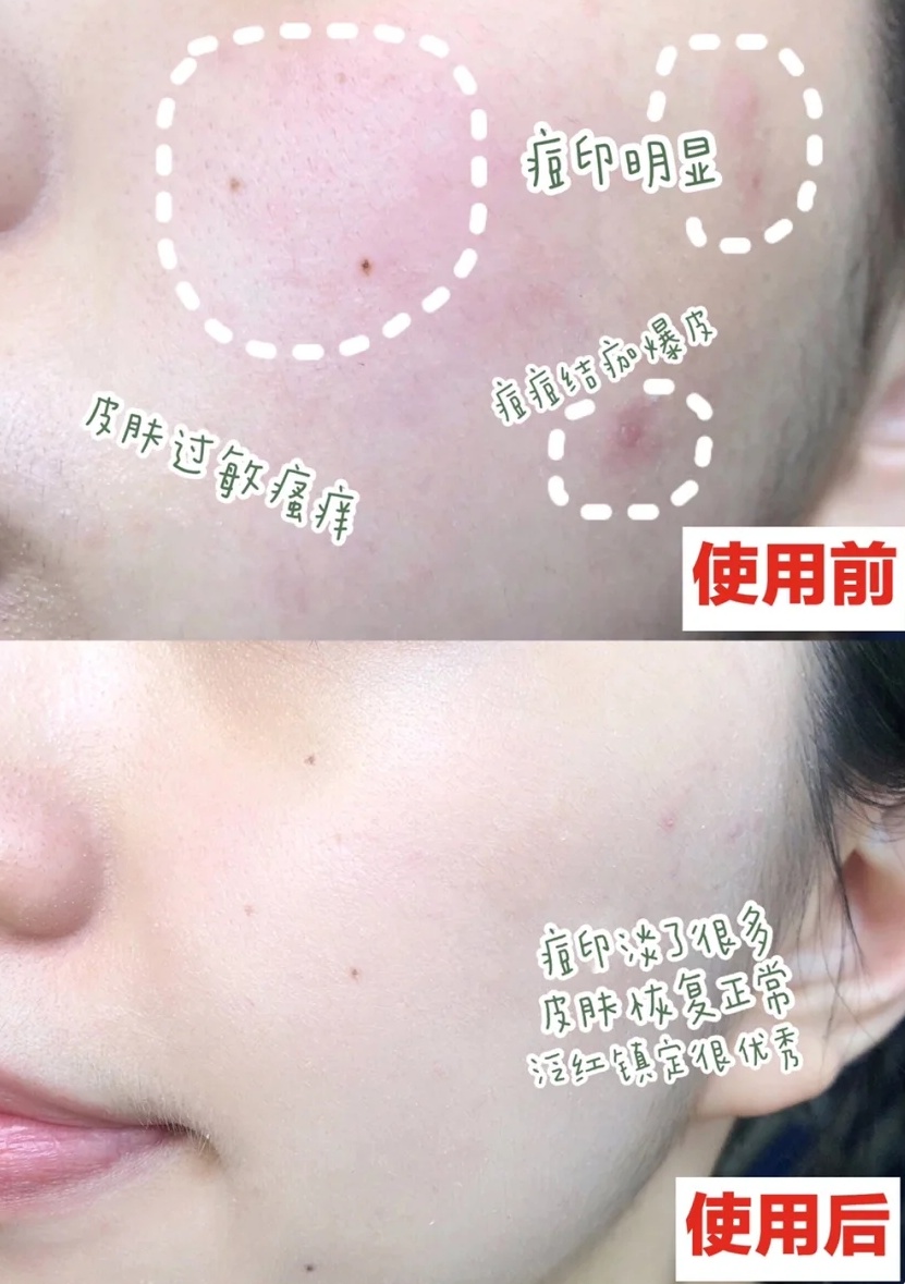 李佳琦推荐的护肤好物，连老爸测评都点赞，价格还不到100元