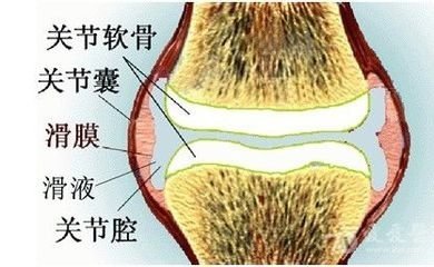 不是膝关节炎打了玻璃酸钠咋办,膝关节炎打玻璃酸钠有副作用吗