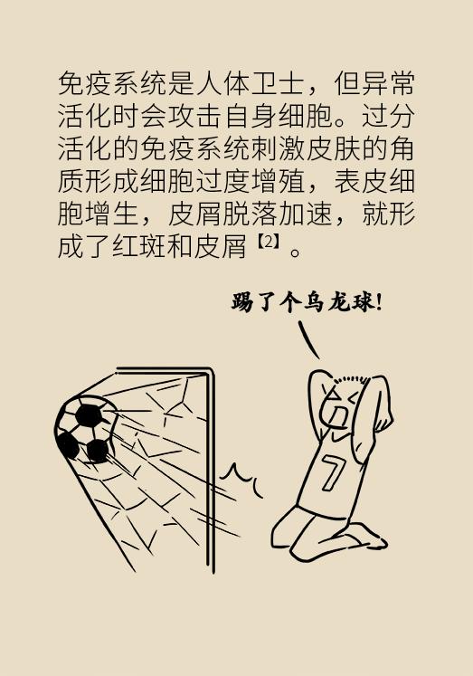 全身红斑起皮屑，这种反复发作的尴尬病，原来是没用对治疗方法