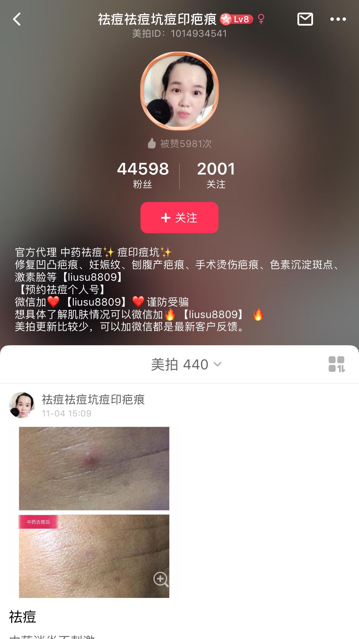 美拍里怎么推广更快,美拍如何给公众号引流