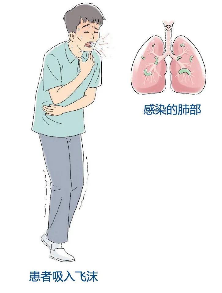 防治耐多药结核病要做好感染控制,2019年中国耐多药结核病治愈率