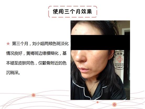 st皮肤修复中心在哪里,妊娠斑修复中心