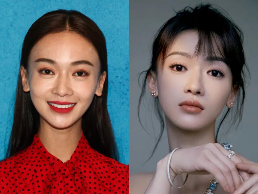 长期中分造成的稀疏可以恢复吗,中分头发留长尴尬期怎么弄