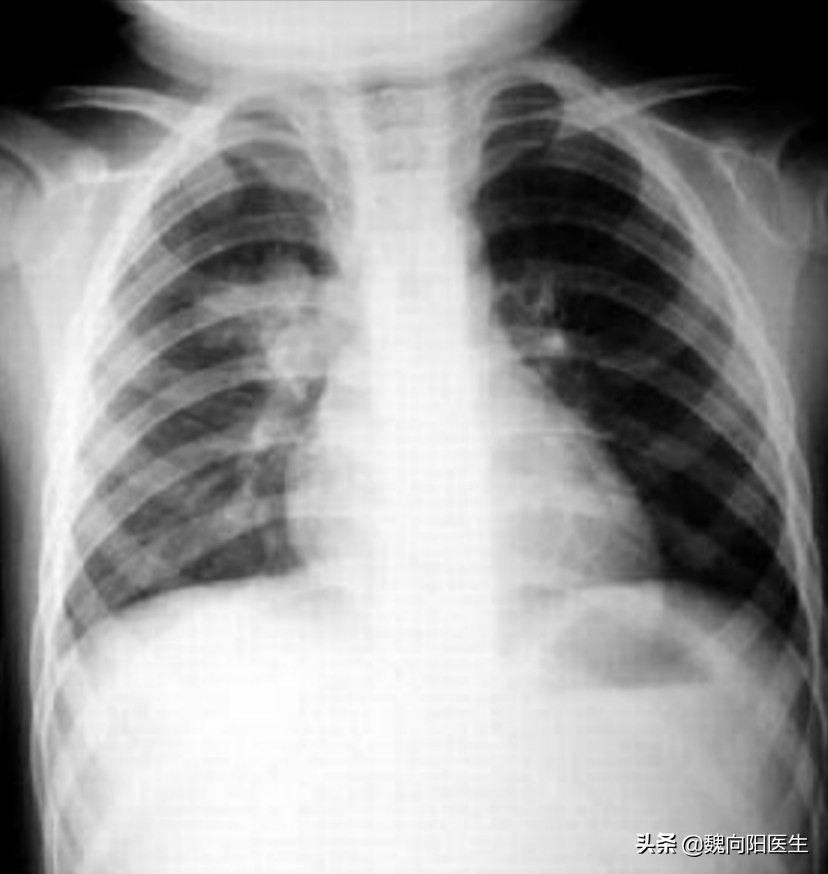 鍎跨鍖荤敓绉戞櫘鑲虹値濡備綍淇濆吇,瀹濆疂鑲虹値瀹堕暱濡備綍鎶ょ悊