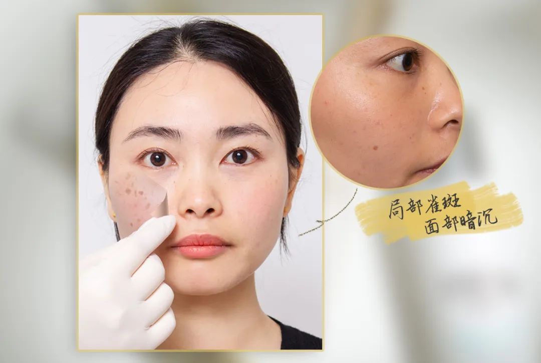 小茂医生美白护肤品,小茂教你如何护肤