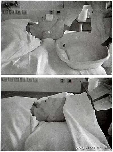 护理老人头发梳理与清洁,头部清理护理套餐