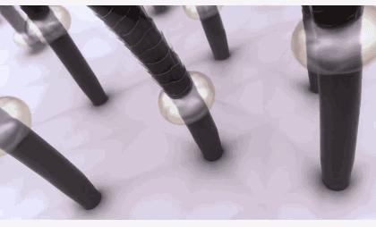 头发毛躁头屑多头皮痒怎么保养,头皮痒头屑多怎么根除