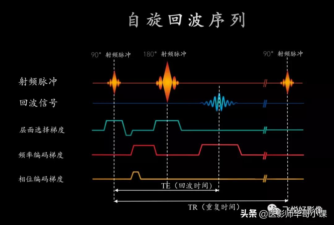 飞利浦磁共振波谱扫描方案,飞利浦1.5t磁共振mri操作使用手册
