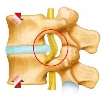 胳膊疼抬不起来理疗手法,胳膊疼的抬不起来怎样锻炼