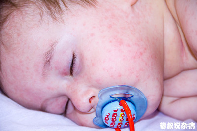 德叔说治病,德叔医话全集