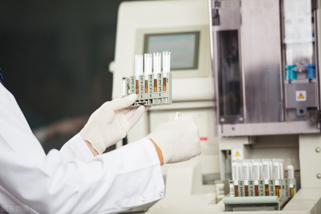 尿常规大部分人都做错了,想要准确的检测结果就要选择这样留尿