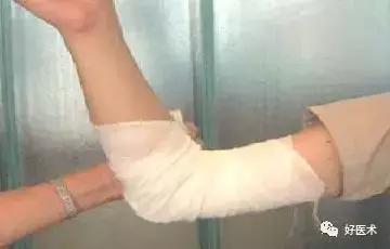 骨科急救处理流程图,骨科急救原则及注意事项