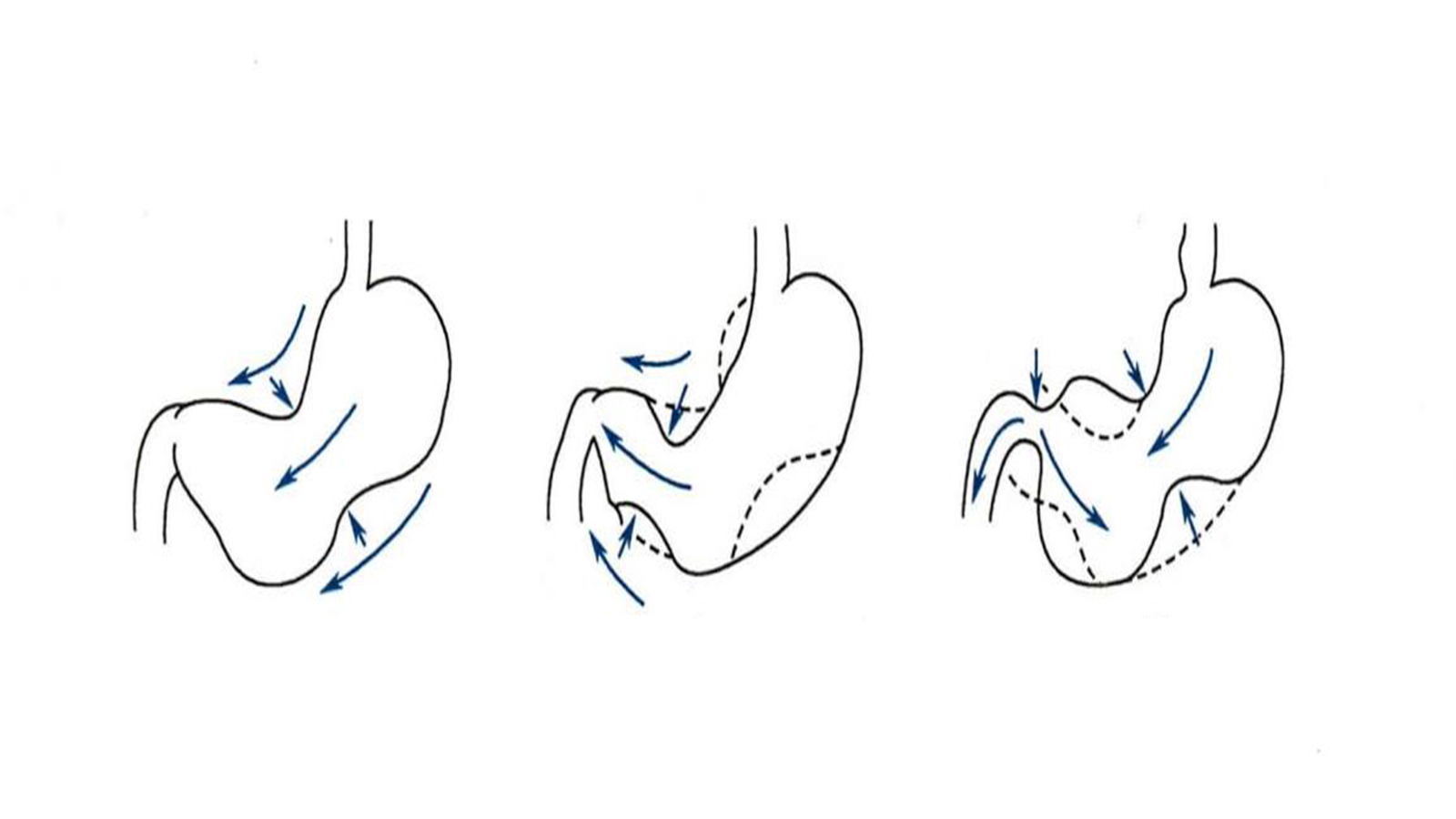 喝酒解酒最简单的方法是什么,喝醉酒解酒的方法都是啥