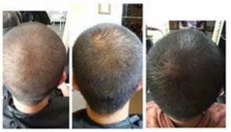 传承与弘扬苗医药,传承苗医