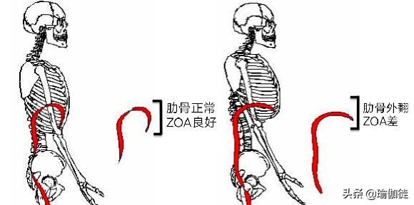 肋骨外翻扩胸运动的正确做法,改善肋骨外翻的运动