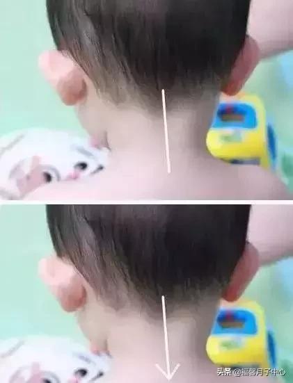 小儿推拿便秘咳嗽,小儿推拿积食通便