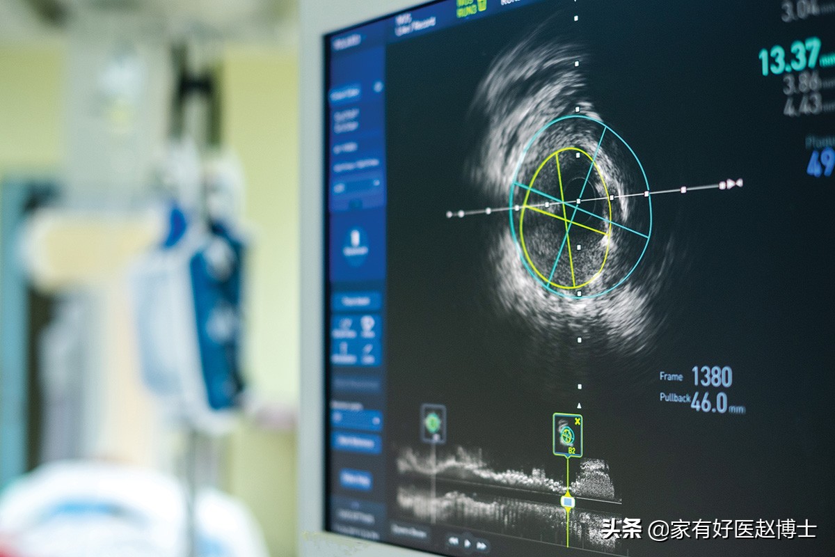 到底能不能软化血管和逆转斑块,使血管斑块变小要用多大剂量他汀