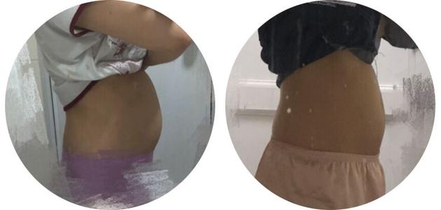 短期内快速发胖只胖肚子什么原因,四肢不胖肚子胖怎么减