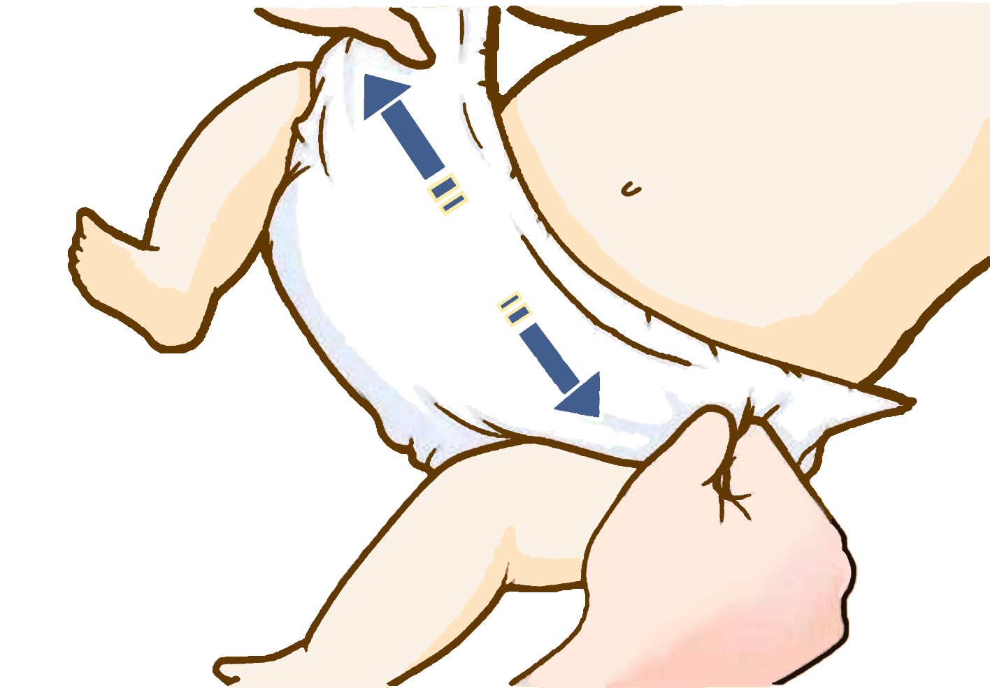 纸尿裤侧漏到咯吱窝的解决办法,宝宝穿纸尿裤总是侧漏怎么回事