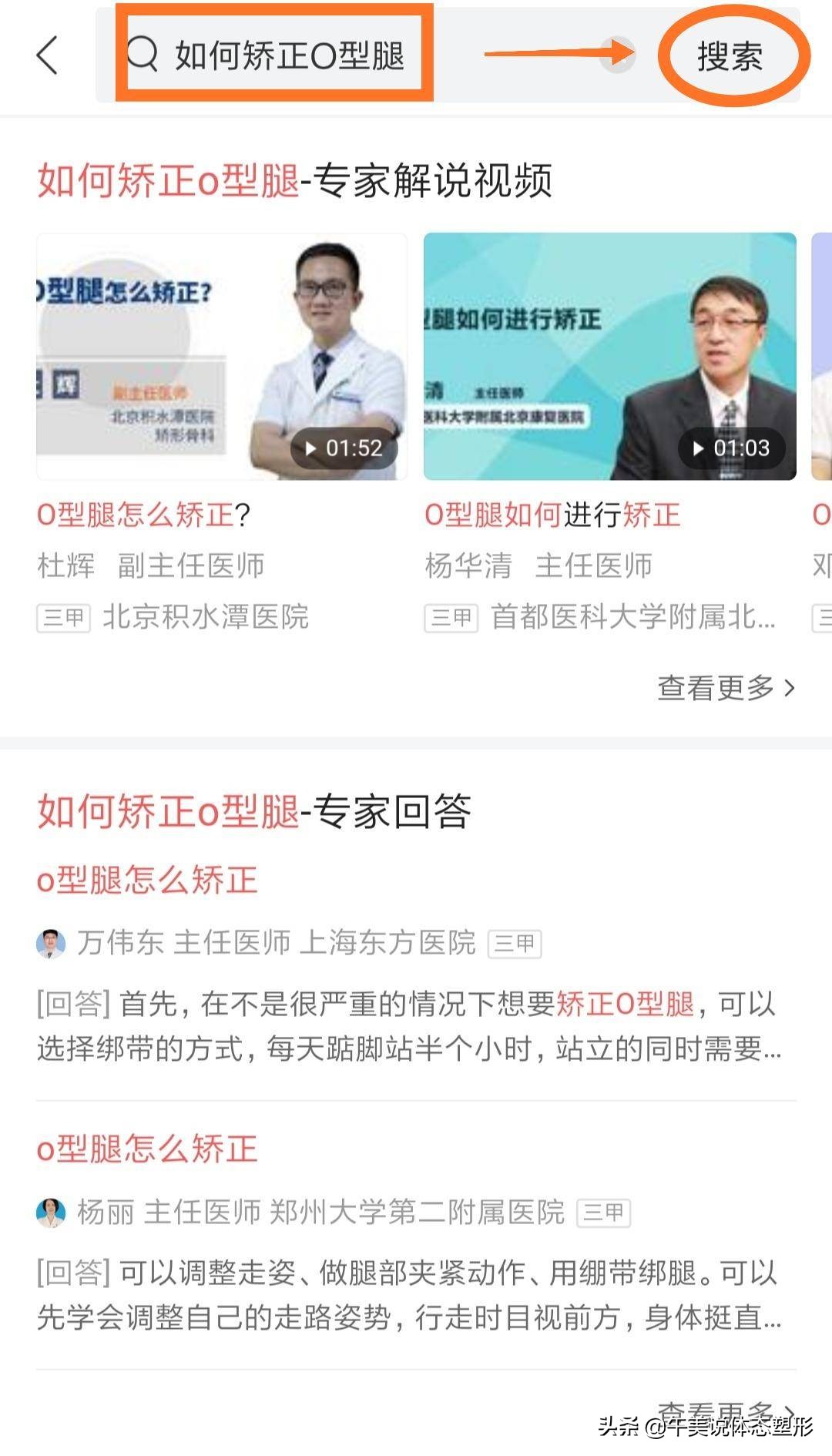 膝盖下o型腿怎么矫正,膝盖腿弯疼最好治疗方法