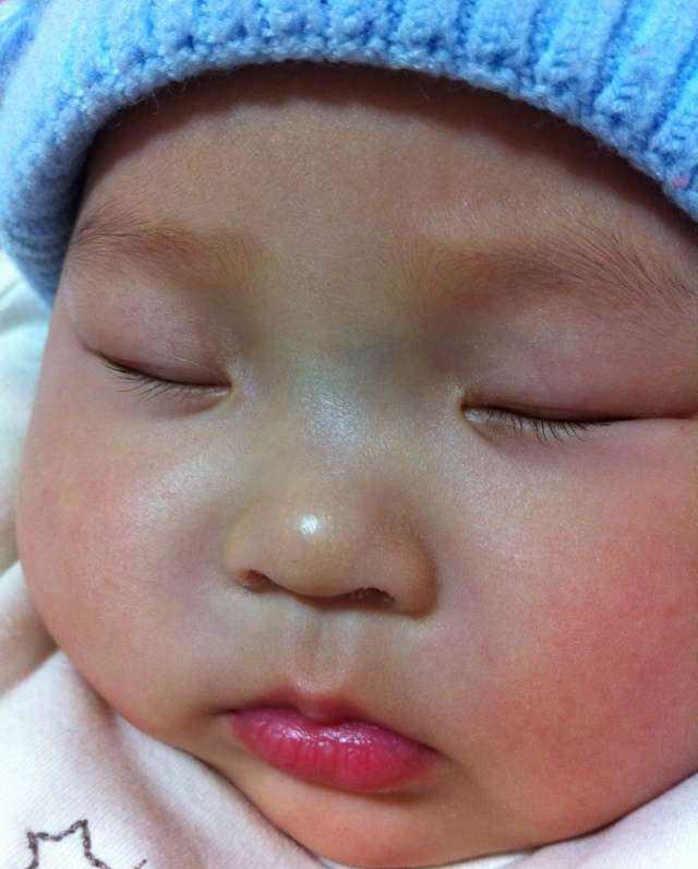 宝宝鼻子有青筋怎么推拿,孩子出生鼻子上有青筋是什么情况