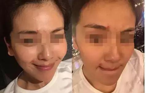 适合皮肤暗黄的护肤品李佳琦推荐,淡斑提亮肤色李佳琦推荐