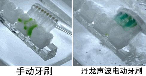 去除牙齿黄垢的神器,牙齿变白除口臭神器