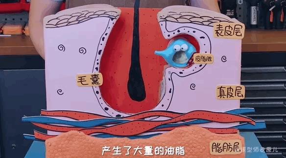 模型师老原儿手被烫伤,模型师老原儿被烫伤