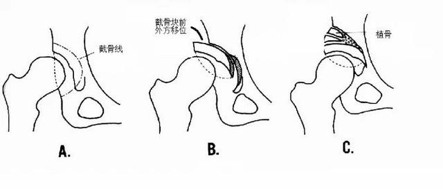 藏獒营养不良什么表现,藏獒趴蹄最佳治疗方法