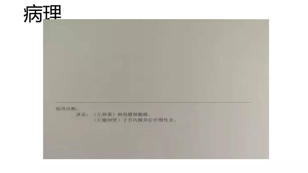 卵巢原发肿瘤的分析思路